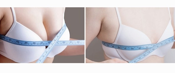 멘토가슴성형? 부작용 걱정된다면 알아야 할 '이것' 사진 5