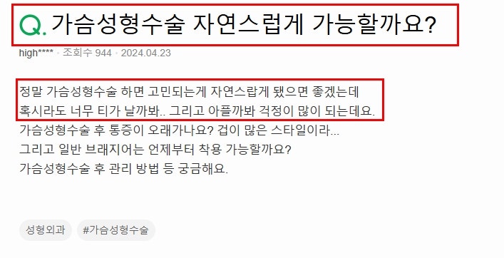 논현가슴성형잘하는곳? 자연스러운 결과 원하는 분들만 보세요 사진 2