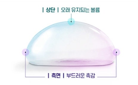 멘토가슴수술 후기? 광고에 속지 않으려면 알아야 할 '이것' 사진 3