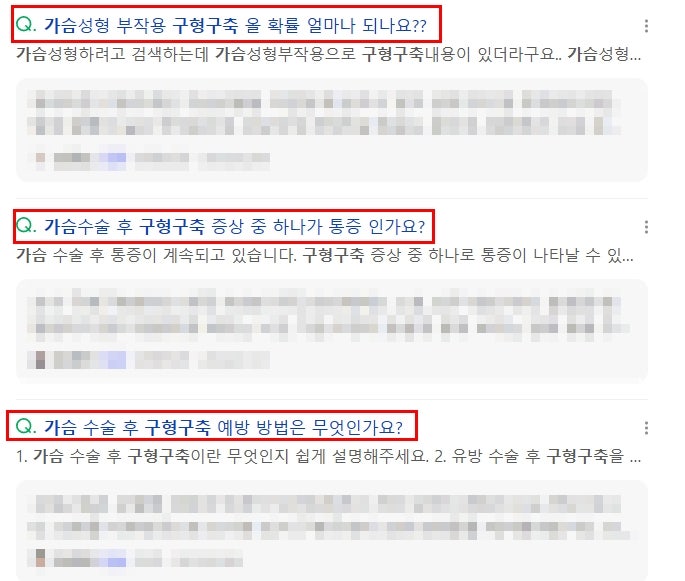 가슴성형 구형구축? 이 글로 종결합니다 사진 2