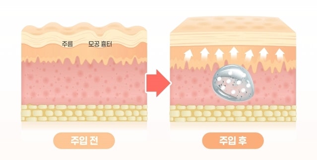 강남역리투오병원? 유행 따라 받다가 돈만 깨집니다 사진 5