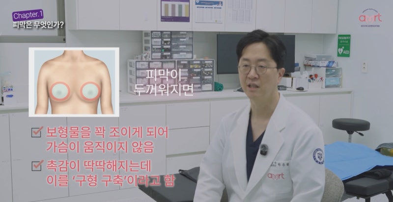 가슴재수술? 10명 중 8명은 '이것' 몰라 두 번째도 실패합니다 - 서초동성형외과 사진 4