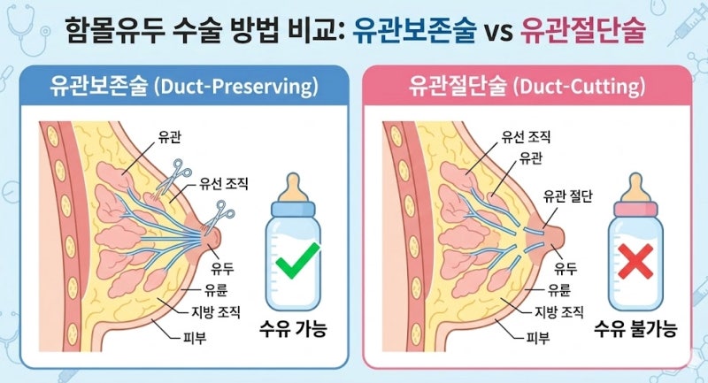 함몰유두 원인과 문제점, 수술 방법까지 총정리 사진 11
