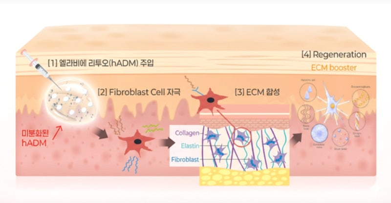 신논현역리투오, 처음이시라면 OO은 알고 받으세요 사진 5