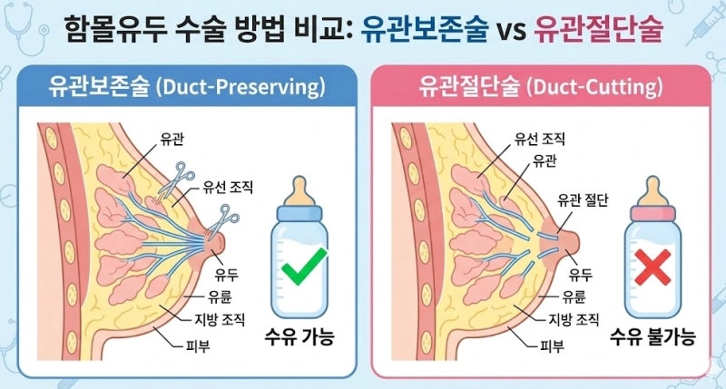 함몰유두수술병원, 콤플렉스 때문에 섣불리 받지 마세요 사진 6