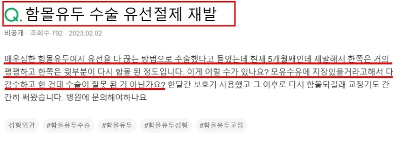 함몰유두수술병원, 콤플렉스 때문에 섣불리 받지 마세요 사진 3