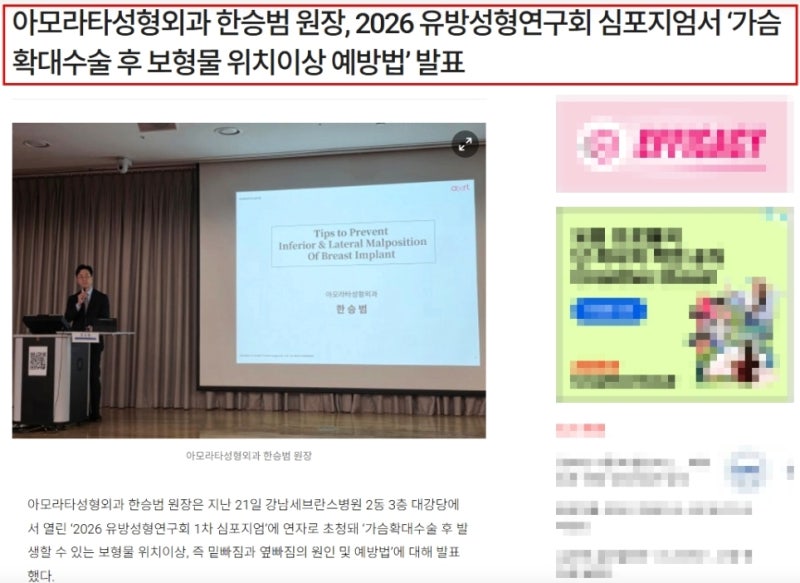강남가슴확대수술? 상담 체크리스트 TOP3 공개 사진 5