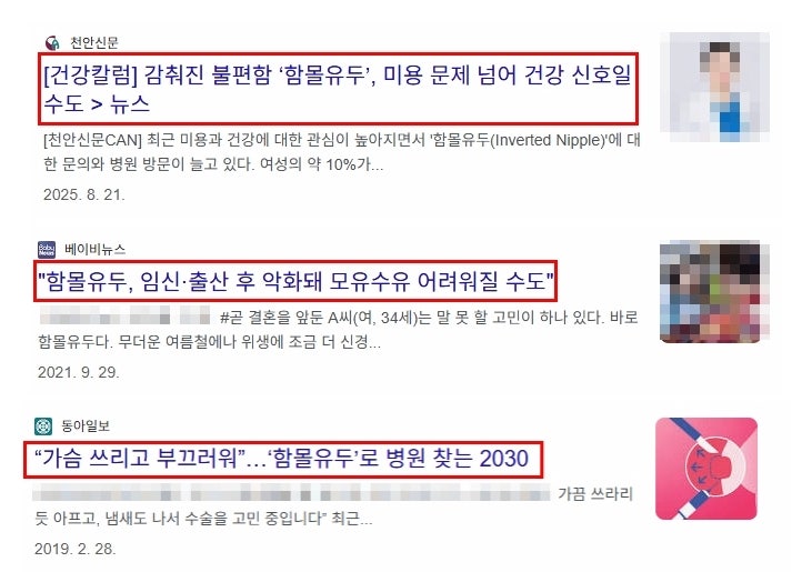 함몰유두수술 비용보다 중요한 기준 1가지 사진 3