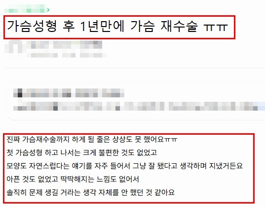 부산가슴성형, 재수술? 비용보다 중요한 기준 사진 2