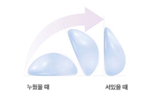 모티바가슴성형, 제일 비싼 보형물이면 무조건 예쁠까요? 사진 7