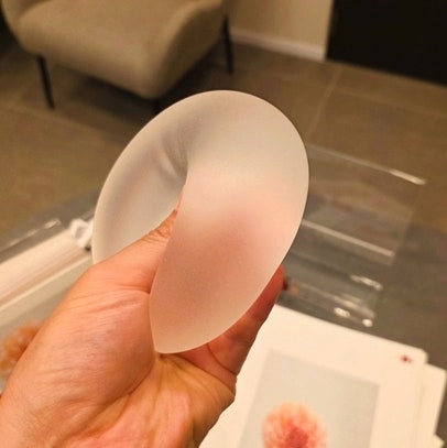 여수가슴성형, 비싼 모티바 보형물로 했는데 재수술까지 가는 이유는? 사진 3