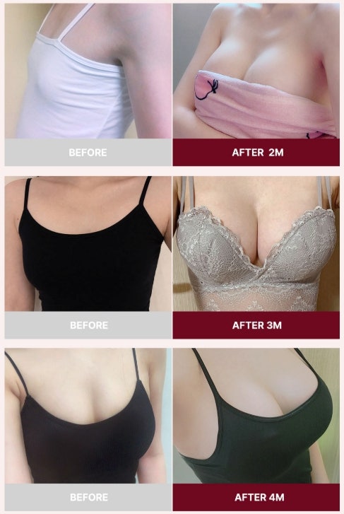 바운스보형물 후기? 매일 인터넷 검색하고 계시는 분들께 드리는 조언 사진 3