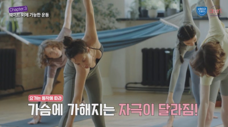 가슴수술 후 운동? 관리 잘못하면 재수술 확정입니다 사진 3
