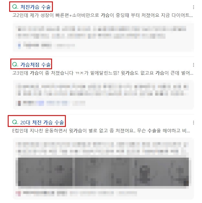 처진 가슴수술? 후기 찾아보기 전 '이것' 만큼은 아셔야 합니다