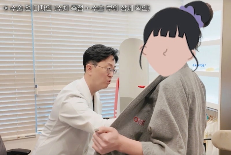 가슴성형 보형물 종류 비교? 모티바 vs 멘토 vs 바운스 사진 10