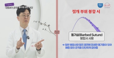 가슴수술 흉터, 겨드랑이 VS 밑선 절개 비교 사진 9