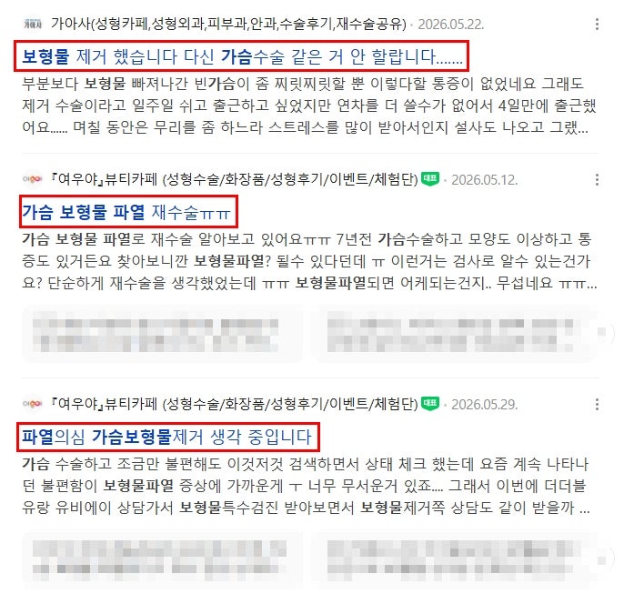 가슴 보형물 파열? 걱정돼서 수술을 망설이는 분들만 보세요 사진 2