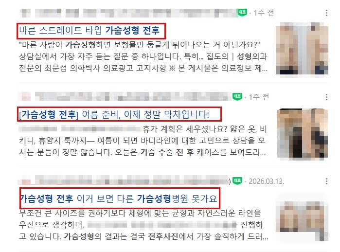가슴성형 전후 사진 후기를 매일 검색하고 있다면 보세요