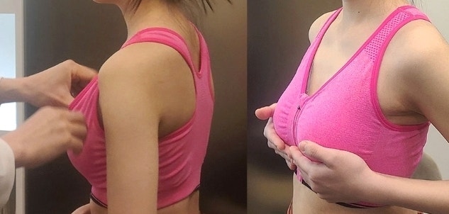 광주 모티바가슴수술? 비싸고 유명하다고 다 좋은 건 아닙니다 사진 8
