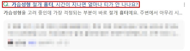 신논현역성형외과, 가슴 수술 자주 묻는 질문 TOP5 사진 3