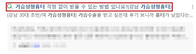 신논현역성형외과, 가슴 수술 자주 묻는 질문 TOP5 사진 4