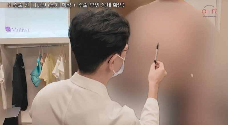 대전가슴수술, 멘토 vs 모티바 보형물 고민? 이 글로 종결합니다 사진 8