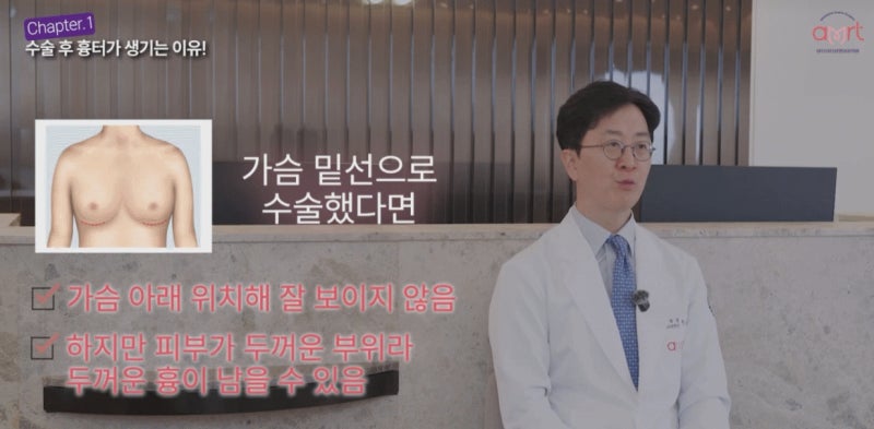 가슴성형 흉터 적게 남는 분들의 특징 2가지 사진 4