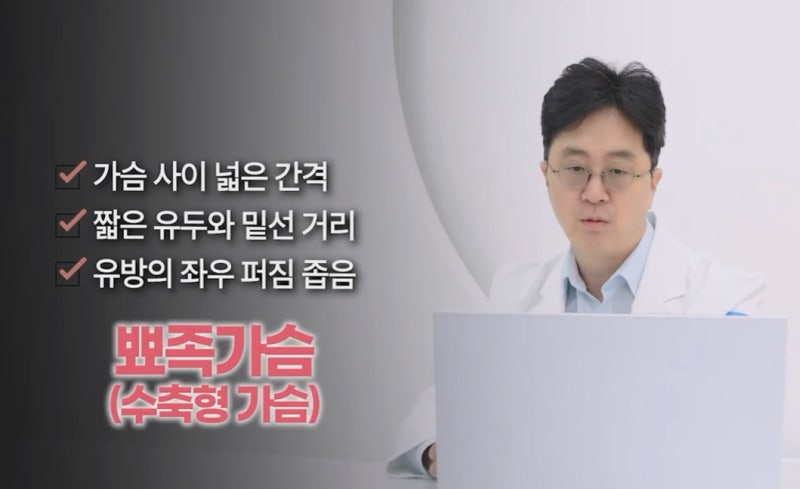 신사역성형외과, 뾰족 가슴 수술 핵심은 OO입니다