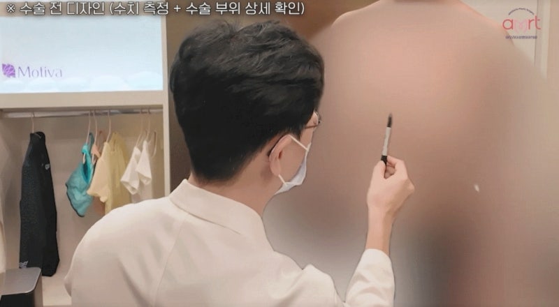 짝가슴 성형, 10명 중 9명이 하는 착각 - 20년 경력 의사 작성
