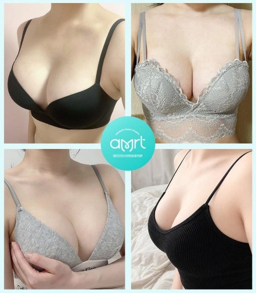 짝가슴 성형, 10명 중 9명이 하는 착각 - 20년 경력 의사 작성 사진 3