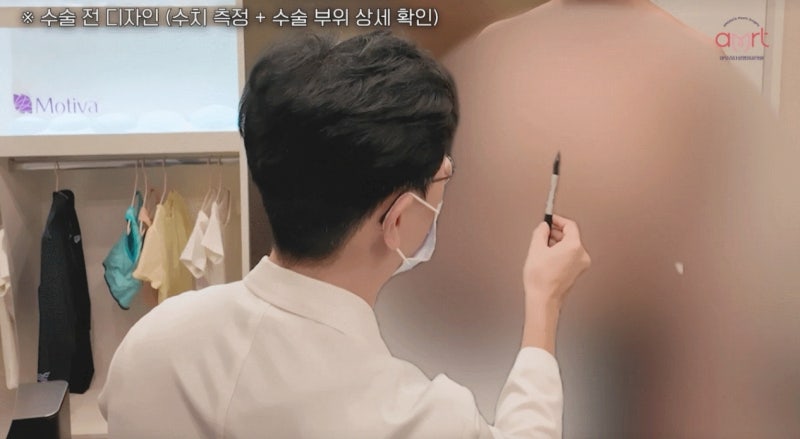 가슴수술 비용, 300 vs 1,000만 원? 호갱 피하는 2가지 기준