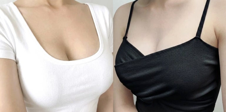 가슴성형 유명한곳? 간판보다 먼저 봐야 할 3가지 기준 사진 2